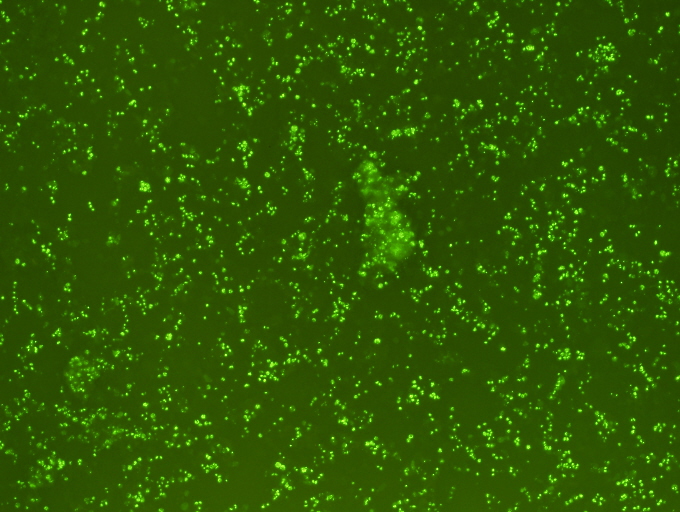 8.绿色荧光蛋白在人源肿瘤细胞中的表达 (2).jpg